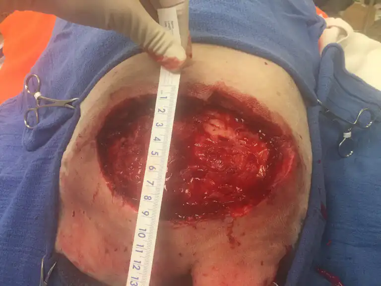 After debridement or cleaning the wound down to healthy tissue