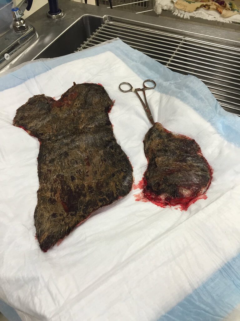Skin removed from her back